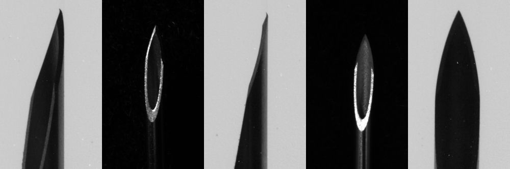 Diverse Spitzendefekte